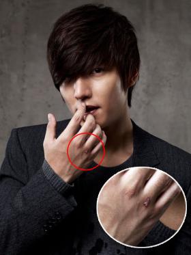 แฟนๆ สงสัยเกี่ยวกับบาดแผลที่ข้อนิ้วของลีมินโฮ (Lee Min Ho)?