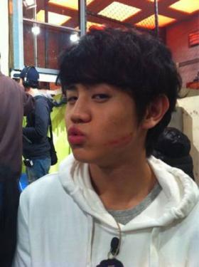 โยซบ (Yoseob) ของวง B2ST ได้รับจูบจากใครบางคน!