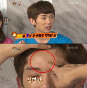 โจควอน (Jo Kwon) เคยได้ฉายา Harry Potter!