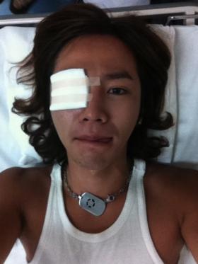 จางกึนซอค (Jang Geun Suk) ติดเชื้อที่ตา!