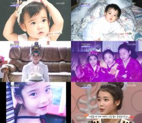 IU เคยผ่านการทำศัลยกรรมมาหรือไม่?