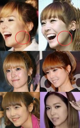 หลายๆ คนสงสัยว่า Jessica ศัลยกรรมโครงหน้าของเธอ?