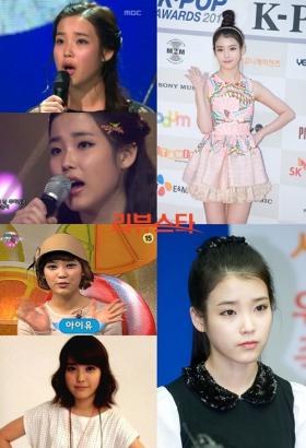 IU ได้รับความสนใจเกี่ยวกับผิวกระจ่างใสมากยิ่งขึ้น!