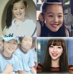 ภาพวัยเด็กของซอลลี่ (Sulli) ก่อนที่จะดัดฟัน!