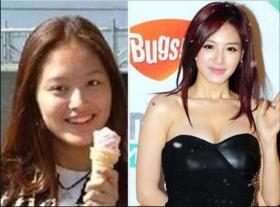 แจคยอง (Kim Jae Kyung) ชนะคดีฟ้องร้องคลินิกศัลยกรรมใช้รูป Before - After โฆษณา