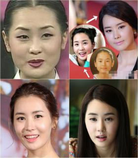 อีดาแฮ (Lee Da Hae) รับแล้วทำศัลยกรรม (นิดหน่อย) ก่อนเข้าวงการ