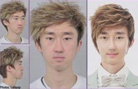 ปาร์คมิน (Park Min) นักร้องเกาหลีผ่ากราม บอกชีวิตเปลี่ยนเป็นคนละคน