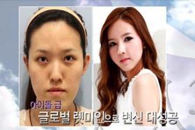 ชีวิตเปลี่ยน! สาวเกาหลีบอกลาความมืดมนทำศัลยกรรมโมหน้าเป็น เจสซิก้า (Jessica)