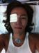 จางกึนซอค (Jang Geun Suk) ติดเชื้อที่ตา!