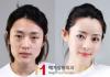 ปาร์คมิน (Park Min) นักร้องเกาหลีผ่ากราม บอกชีวิตเปลี่ยนเป็นคนละคน