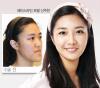 ปาร์คมิน (Park Min) นักร้องเกาหลีผ่ากราม บอกชีวิตเปลี่ยนเป็นคนละคน