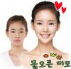 ปาร์คมิน (Park Min) นักร้องเกาหลีผ่ากราม บอกชีวิตเปลี่ยนเป็นคนละคน