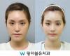 ปาร์คมิน (Park Min) นักร้องเกาหลีผ่ากราม บอกชีวิตเปลี่ยนเป็นคนละคน