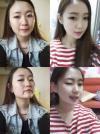 ปาร์คมิน (Park Min) นักร้องเกาหลีผ่ากราม บอกชีวิตเปลี่ยนเป็นคนละคน