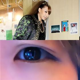 CL ไปทำศัลยกรรมตา 2 ชั้น?